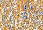 FceR1 alpha Antibody in Immunohistochemistry (Paraffin) (IHC (P))