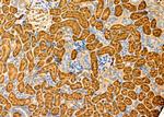 FceR1 alpha Antibody in Immunohistochemistry (Paraffin) (IHC (P))
