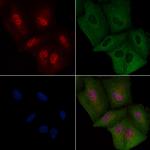 FGF1 Polyclonal Antibody