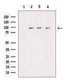 FGFR1/FGFR2 Polyclonal Antibody