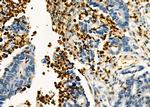 FGL2 Antibody in Immunohistochemistry (Paraffin) (IHC (P))