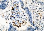 FGL2 Polyclonal Antibody