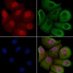 FHL2 Polyclonal Antibody