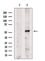Fibromodulin Polyclonal Antibody