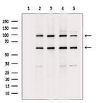 Filaggrin Antibody in Western Blot (WB)