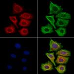 Filaggrin Polyclonal Antibody