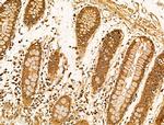 Filaggrin Antibody in Immunohistochemistry (Paraffin) (IHC (P))