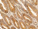 Filaggrin Antibody in Immunohistochemistry (Paraffin) (IHC (P))
