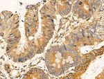 Filaggrin Antibody in Immunohistochemistry (Paraffin) (IHC (P))