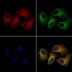 Filamin B Polyclonal Antibody