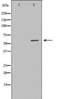 FMO3 Polyclonal Antibody