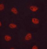 FosB Polyclonal Antibody