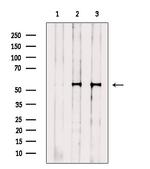 FOXF1 Polyclonal Antibody