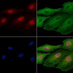 FOXF2 Polyclonal Antibody