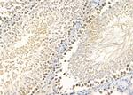 FOXG1 Polyclonal Antibody