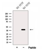 FOXR2 Antibody in Western Blot (WB)