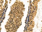 Fra1 Polyclonal Antibody