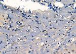 Fascin Polyclonal Antibody