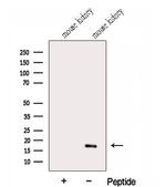 GABARAPL1 Antibody in Western Blot (WB)