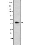 GALR3 Antibody in Western Blot (WB)