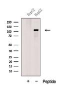 GART Polyclonal Antibody