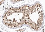 GPRASP1 Antibody in Immunohistochemistry (Paraffin) (IHC (P))