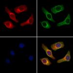 Bombesin Polyclonal Antibody