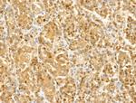 GCHFR Antibody in Immunohistochemistry (Paraffin) (IHC (P))