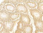 GCHFR Antibody in Immunohistochemistry (Paraffin) (IHC (P))