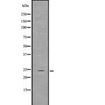 GDNF Polyclonal Antibody