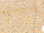 GGCT Polyclonal Antibody