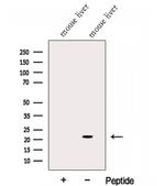 GGCT Antibody in Western Blot (WB)