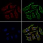 CRG-L2 Polyclonal Antibody