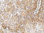 GLUT5 Antibody in Immunohistochemistry (Paraffin) (IHC (P))