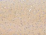 GLUT5 Antibody in Immunohistochemistry (Paraffin) (IHC (P))