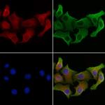 Glypican 2 Polyclonal Antibody