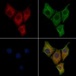 GM2A Polyclonal Antibody