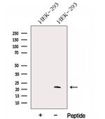 GM2A Antibody in Western Blot (WB)