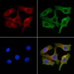 ZDHC3 Polyclonal Antibody