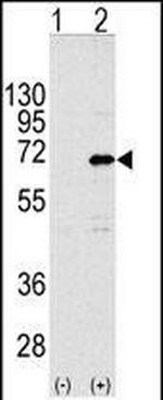 CNOT4 Polyclonal Antibody