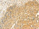 GOLIM4 Polyclonal Antibody