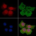 gp210 Polyclonal Antibody