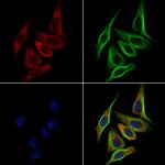 GPR182 Polyclonal Antibody