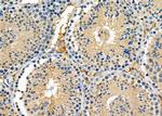 GRID2 Polyclonal Antibody