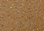 HSPA9 Antibody in Immunohistochemistry (Paraffin) (IHC (P))