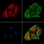 GSDMD Polyclonal Antibody