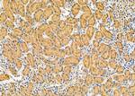 GSR Polyclonal Antibody