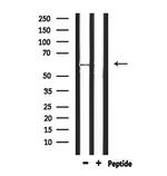 GSR Antibody in Western Blot (WB)