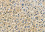 GTPBP1 Polyclonal Antibody