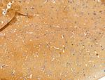 GUCY1A2 Antibody in Immunohistochemistry (Paraffin) (IHC (P))